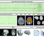 Ihnen and Arya Epilepsy Essentials column article figure 1