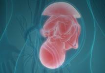 Alloimmune Thrombocytopenia in the Fetus and Newborn