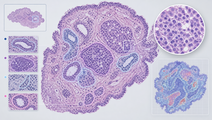 artificial intelligence in histopathology and cytopathology