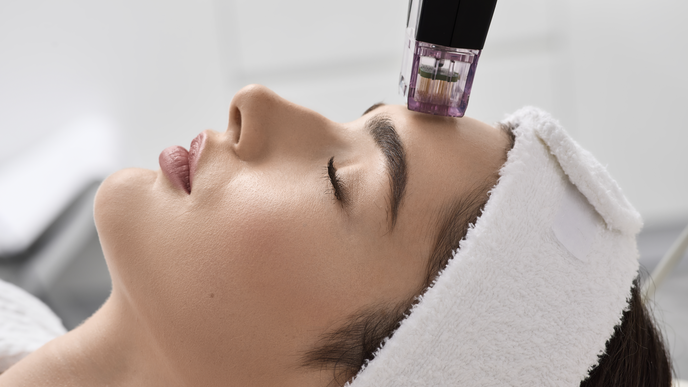 RF Microneedling