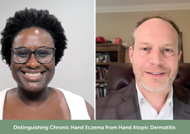 Distinguishing Chronic Hand Eczema from Hand Atopic Dermatitis