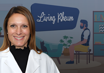 Differentiating and Diagnosing Sjögren’s-Related Dry Eye