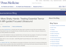 focused ultrasound for essential tremor