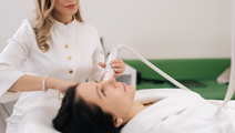 microneedling