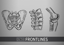 Preventing Osteoporosis with Hormone Therapy: How to Select Appropriate Patients