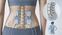 tens lowers movement evoked pain in fibromyalgia trial