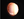 Figure 1. A well-centered three-piece IOL
in the right eye.