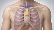 single port robotic thymectomy at miami early experience and recovery