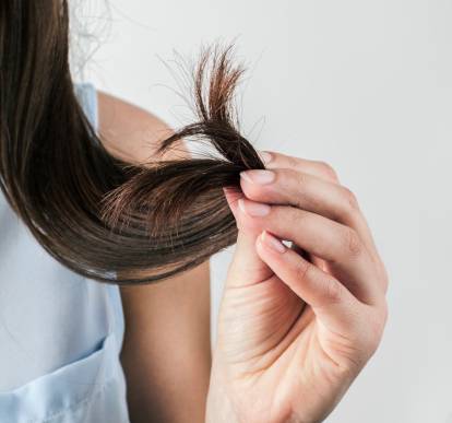 Alopecia