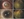 2155 Supp_Fig 9_refractory scleritis and uveitis