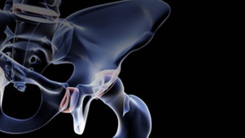 Medical Program: Treating Hip Fractures in Elderly ...