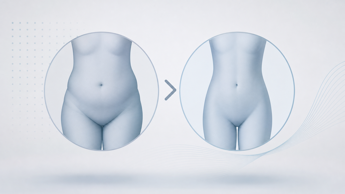 semaglutide 72 mg in obesity step up trial readout