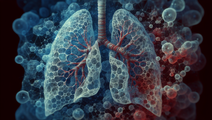 Unraveling the Immune Puzzle How Misplaced Cells Drive Aggressive Lung Disease