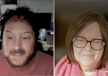 Treatment Advances in Generalized Myasthenia Gravis: Clinical and Laboratory Criteria for Diagnosis and Optimal Treatment Selection