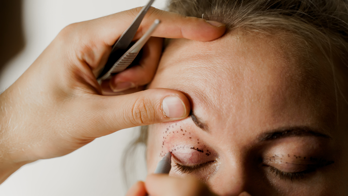 blepharoplasty
