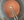Figure 1. After lens removal and posterior capsular polishing are complete, a central posterior capsular incision is made with a needle, and a PCR is begun with forceps.