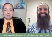 Seeing Beyond Skin Scores and Rethinking Severity in Plaque Psoriasis