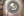 Figure 2. The surgeon used an OVD to open the capsular
bag, which enabled him to elevate the IOL into the anterior
chamber.