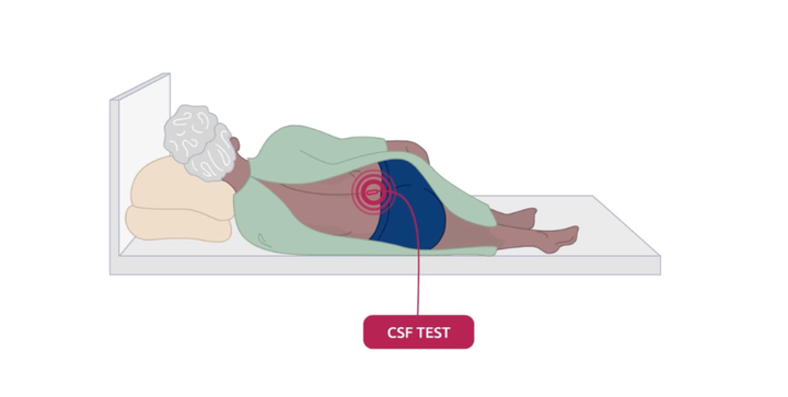 CSF Test Image