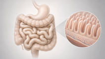 Simplified small intestine and intestinal lining illustrating the dietary context of celiac disease