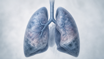 NEXIS Trial Finds No Functional Gain From Early Cycling Plus Amino Acids