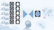 Five CT Brain Masks Improved Cross Center UNet Performance