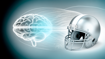 Exploring the Silent Dangers of Repetitive Head Impacts in Athletes