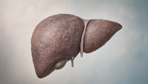 Editorial illustration of a liver with subtle cirrhotic texture representing decompensated cirrhosis