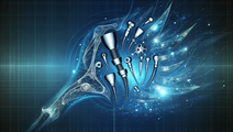 tibial fracture dynamic fixation