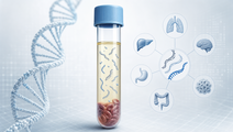 real world use of a 1021 gene liquid biopsy assay