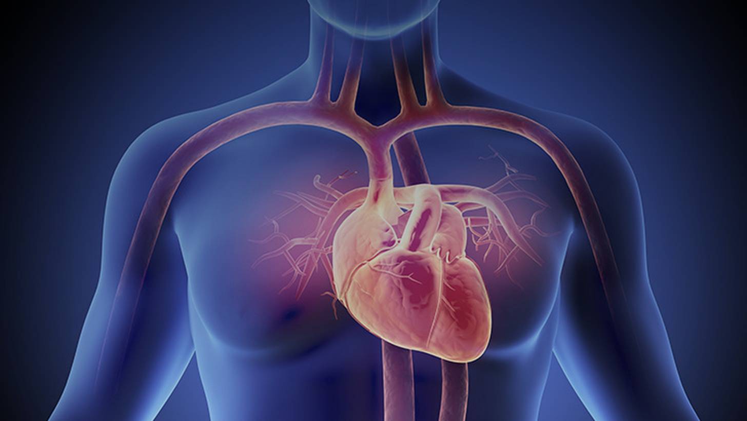 CME; CCM, Optimizer, HFrEF, heart failure, device, ejection