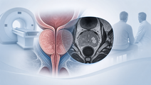 prostate mri screening standards and test performance