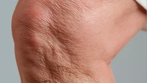 Knee skin