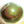 Figure 1. Preoperative appearance of the right eye.
Note the superior iris defects, dilated pupil, and nasally
subluxated cataract.