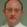 Allen Anderson, MD