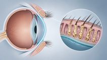 technology based dry eye interventions rank differently by outcome