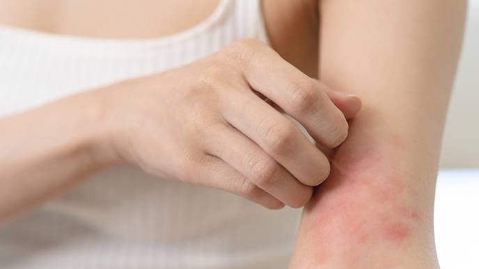 rash reduction