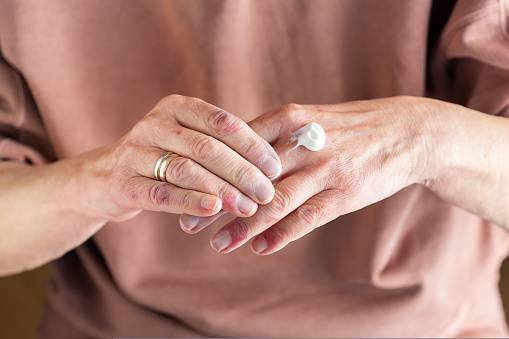 Chronic Hand Eczema