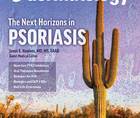 psoriasis