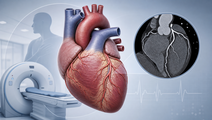 TARGETCTCA Found No Benefit for Routine CT Coronary Angiography