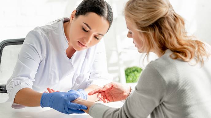 atopic dermatitis