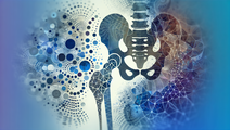 autologous cartilage cell approaches hip repair
