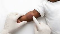 pediatric care disparities