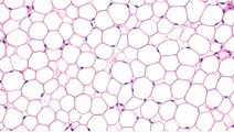 Adipocytes