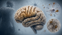 CTE prevalence at death in former NFL players
