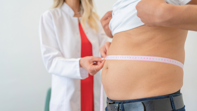 Weigh loss surgeries