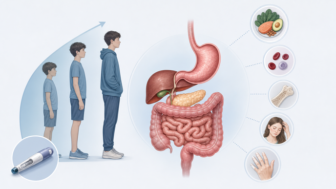 Adolescent digestive system illustration highlighting nutritional deficiency risk with GLP1 receptor agonist use