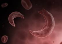Beyond the Data: Improving the Lives of People with Sickle Cell Disease
