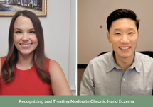 Recognizing and Treating Moderate Chronic Hand Eczema