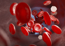 Febrile Neutropenia